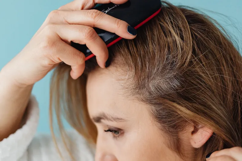 Caspa y dermatitis seborreica: dos condiciones distintas que exigen tratamientos distintos